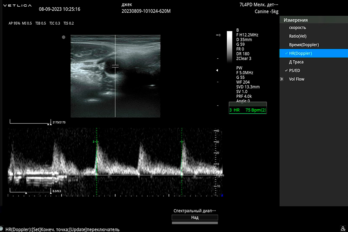 Техника подсчета частоты сердечных сокращений на УЗИ