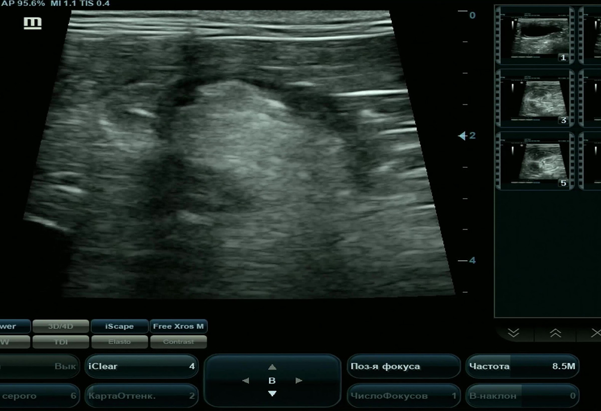 Плановое УЗИ органов брюшной полости собак породы такса