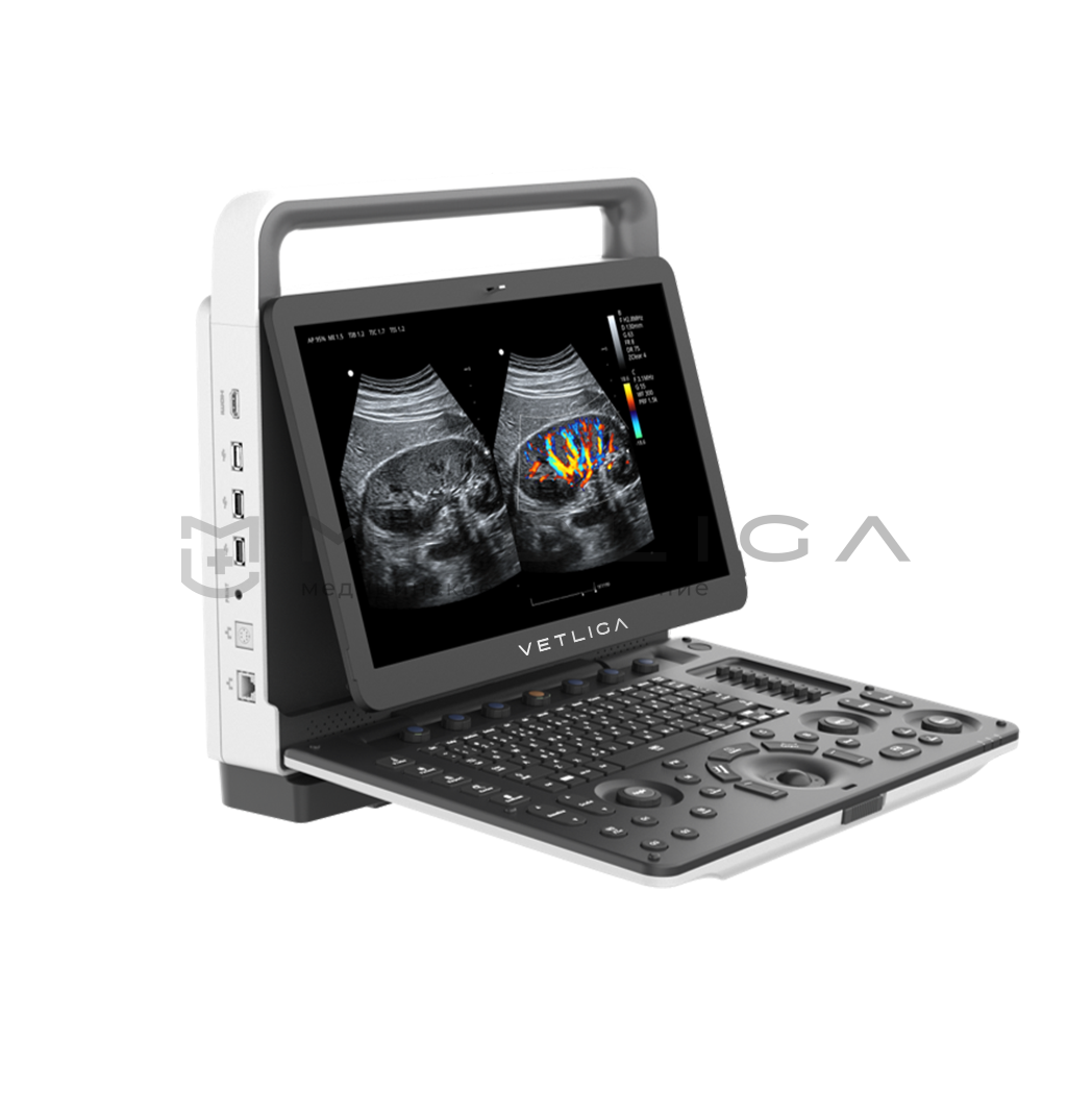 Ветеринарный УЗИ аппарат VETLIGA M70 Vet