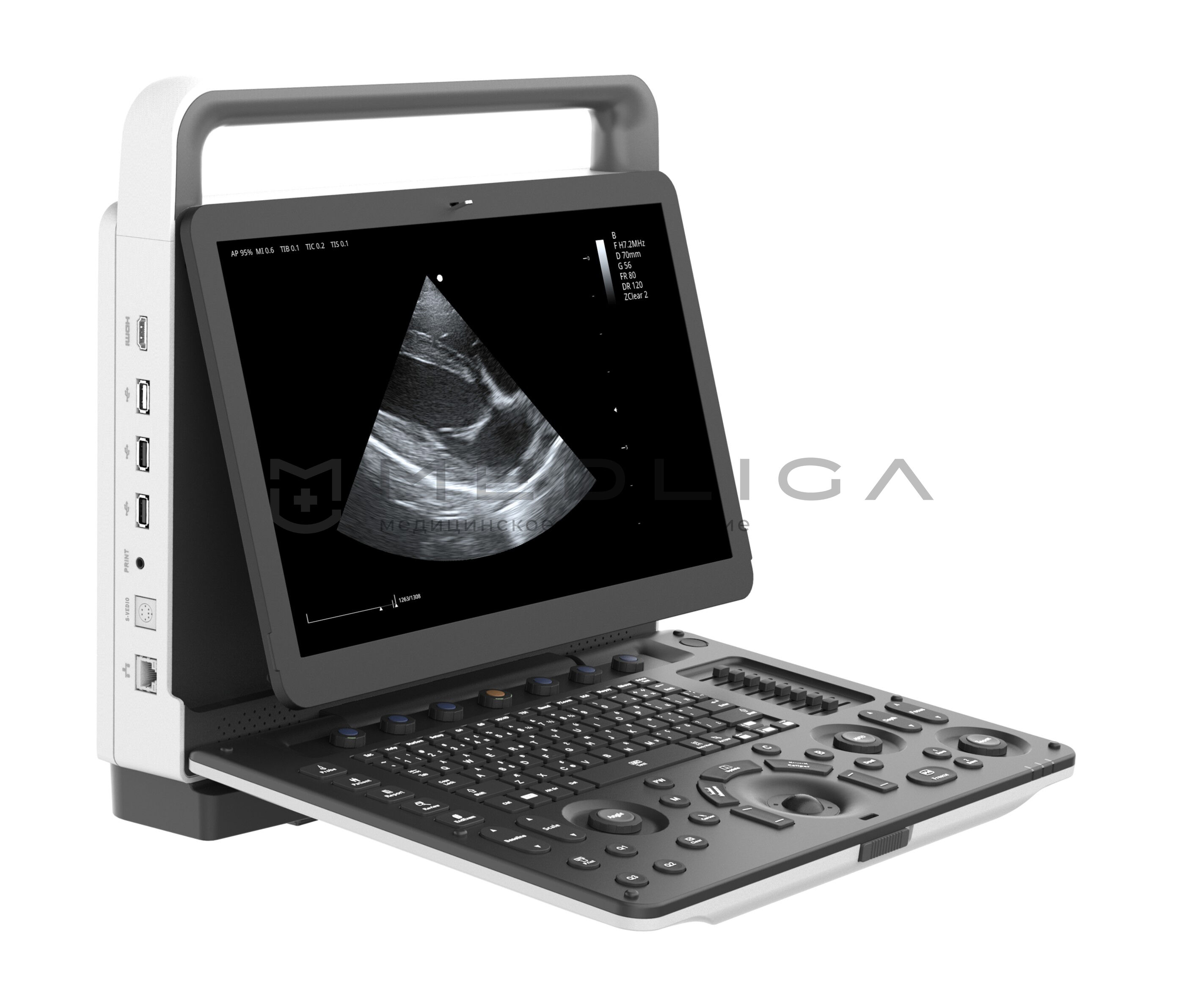 Ветеринарный УЗИ-сканер VETLIGA MV-3 Exp