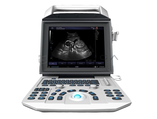 Ультразвуковой сканер Zoncare V7 для ветеринарии