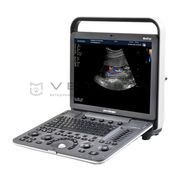 SonoScape S8Exp Vet